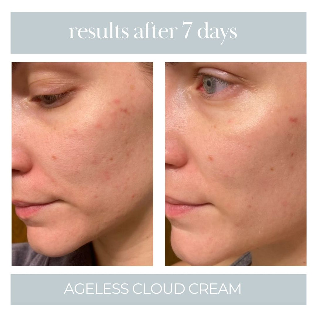 Ageless Cloud Cream